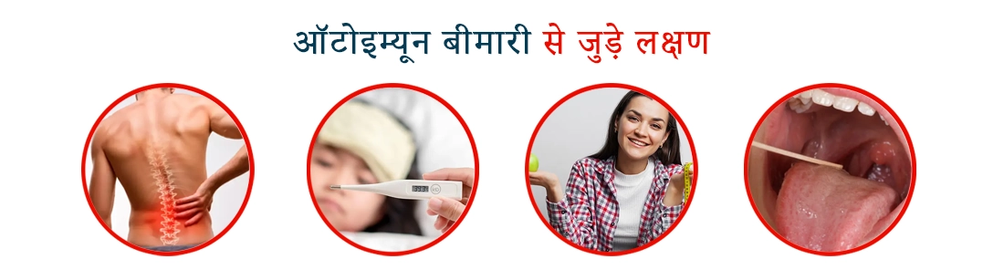 Symptoms Associated With Autoimmune Disease in Hindi